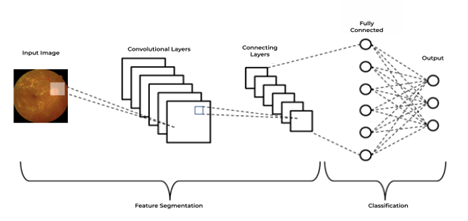 Діаграма архітектури згорткової нейронної мережі для класифікації діабетичної ретинопатії
